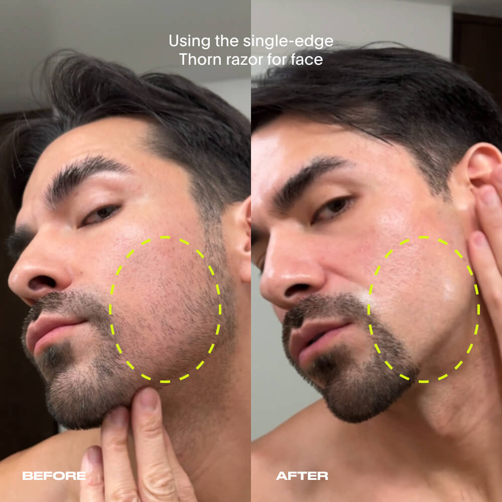 Single-Edge Razor Bundles
